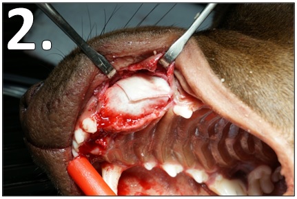 Fascia in the maxillary extraction site