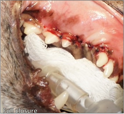 VTS Allograft Bone Membrane Oronasal Fistula Dentistry Full Closure 2