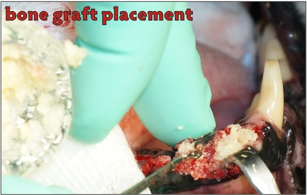 VTS Xenograft Orthomix Dental Extraction Graft Placement