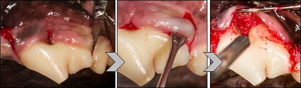VTS Allograft Mini Block Guided Tissue Regeneration Dental Defect Exposure