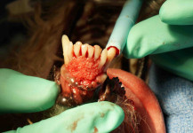 Packing Periomix® Bone Graft Around Roots