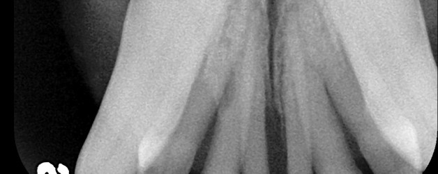 Can these teeth be saved?